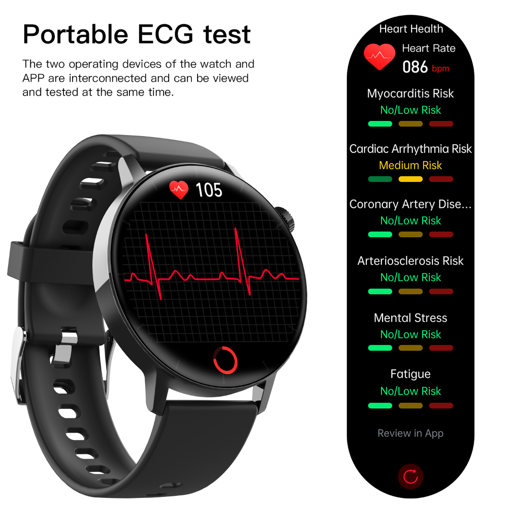 ECG monitor Smart Watch