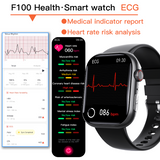 Best ECG Smart Watch of 2024 With Blood Pressure Monitor+Blood Glucose Monitoring