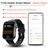 Best ECG Smart Watch of 2024 With Blood Pressure Monitor+Blood Glucose Monitoring